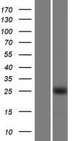 KLF16 Human Over-expression Lysate