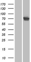 USHBP1 Human Over-expression Lysate