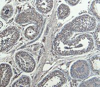 Goat anti-HOXA10 Antibody