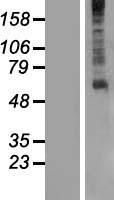 GPR61 Human Over-expression Lysate