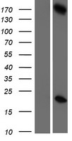 Haspin (GSG2) Human Over-expression Lysate