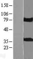 KCTD10 Human Over-expression Lysate