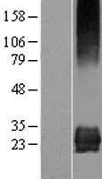 STARD3NL Human Over-expression Lysate