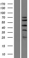 C1orf124 (SPRTN) Human Over-expression Lysate