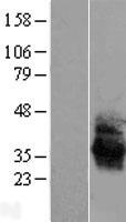 Angiotensin II Type 1 Receptor (AGTR1) Human Over-expression Lysate