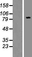 FBXO30 Human Over-expression Lysate