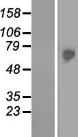 TKTL2 Human Over-expression Lysate