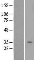 TOMM40L Human Over-expression Lysate