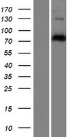 CEP78 Human Over-expression Lysate