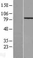 ACAD11 Human Over-expression Lysate