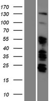 ARID5B Human Over-expression Lysate