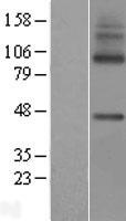 SLC49A3 Human Over-expression Lysate