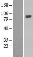 LOXL4 Human Over-expression Lysate