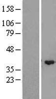 ZMYND12 Human Over-expression Lysate