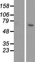 SETD3 Human Over-expression Lysate