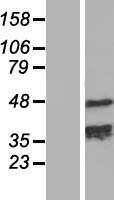 TCHP Human Over-expression Lysate