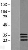 DNAJC30 Human Over-expression Lysate