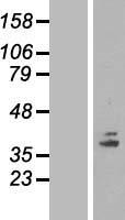 COQ5 Human Over-expression Lysate