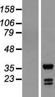 ING5 Human Over-expression Lysate