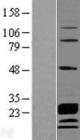 CCDC115 Human Over-expression Lysate