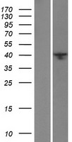 BRMS1L Human Over-expression Lysate