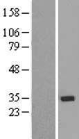 ZNF397 Human Over-expression Lysate