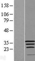 WIBG (PYM1) Human Over-expression Lysate