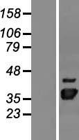 NUDT22 Human Over-expression Lysate