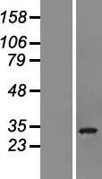 CHCHD6 Human Over-expression Lysate