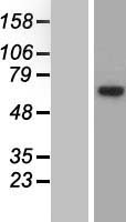EEF1D Human Over-expression Lysate