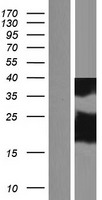 DYDC2 Human Over-expression Lysate