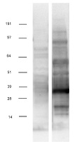 ZBED3 Human Over-expression Lysate