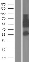 ZNF289 (ARFGAP2) Human Over-expression Lysate