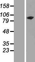 C13orf8 (CHAMP1) Human Over-expression Lysate