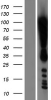 DOT1L Human Over-expression Lysate
