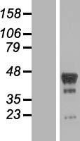 PHD finger protein 6 (PHF6) Human Over-expression Lysate