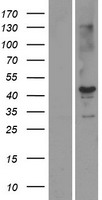 STK19 Human Over-expression Lysate