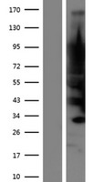JPH4 Human Over-expression Lysate