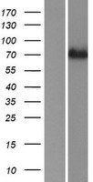 ACSS1 Human Over-expression Lysate