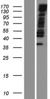 MYPN Human Over-expression Lysate