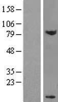 DPY30 Human Over-expression Lysate