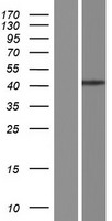 MURF1 (TRIM63) Human Over-expression Lysate