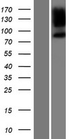 PPP1R9B Human Over-expression Lysate