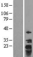 TMEM147 Human Over-expression Lysate