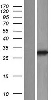 PPAPDC3 (PLPP7) Human Over-expression Lysate