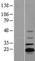 ADTRP Human Over-expression Lysate