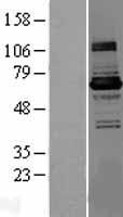 KLHL22 Human Over-expression Lysate