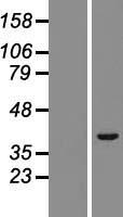 TRIM52 Human Over-expression Lysate