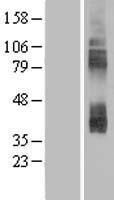SLC7A3 Human Over-expression Lysate