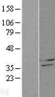 CBR4 Human Over-expression Lysate